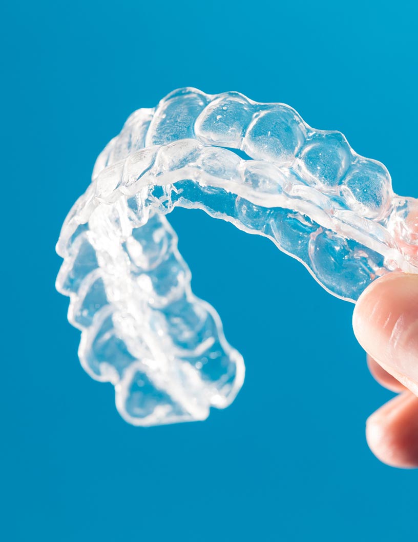 invisible orthodontics market in North America 2024-2028