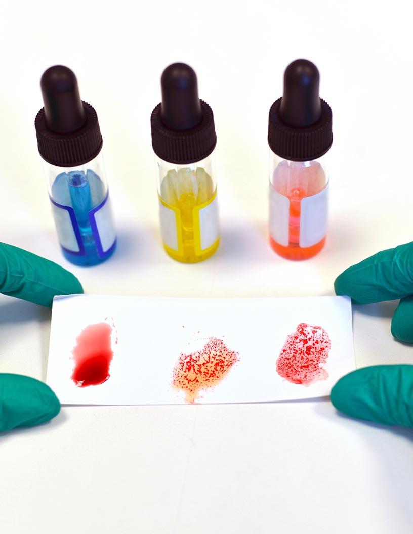 Global Blood-Grouping Reagents Market 2025-2029