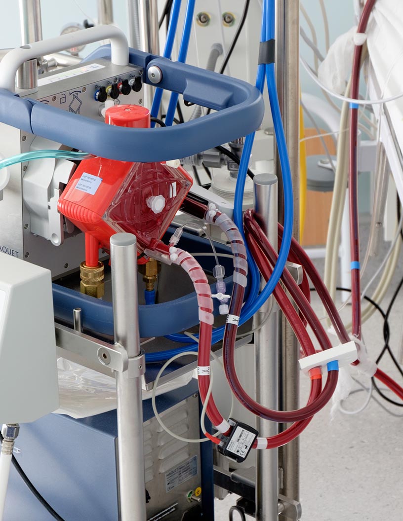 Global Extracorporeal Membrane Oxygenation Machines Market 2024-2028