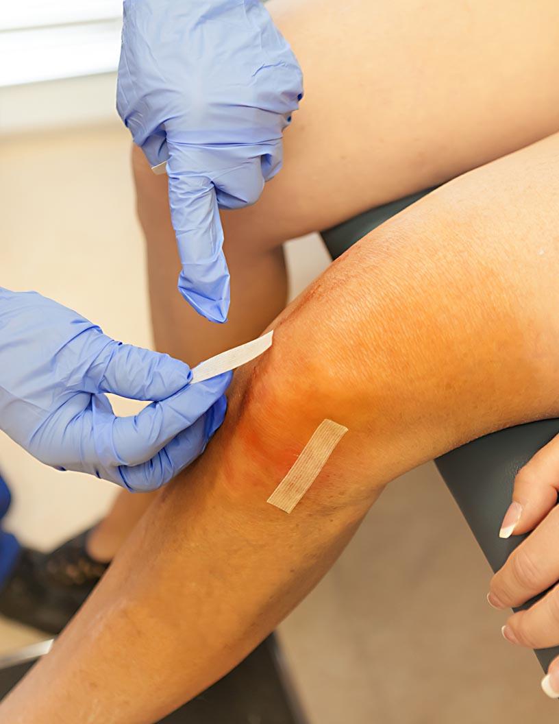 Global Wound Closure Strips Market 2025-2029