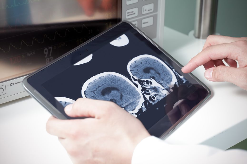 Top Drivers for Medical Image Analysis Software Market Size to Grow by $ 1.53 bn During 2021-2025