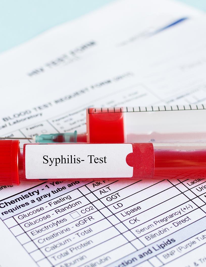 Global Syphilis Testing Market 2025-2029