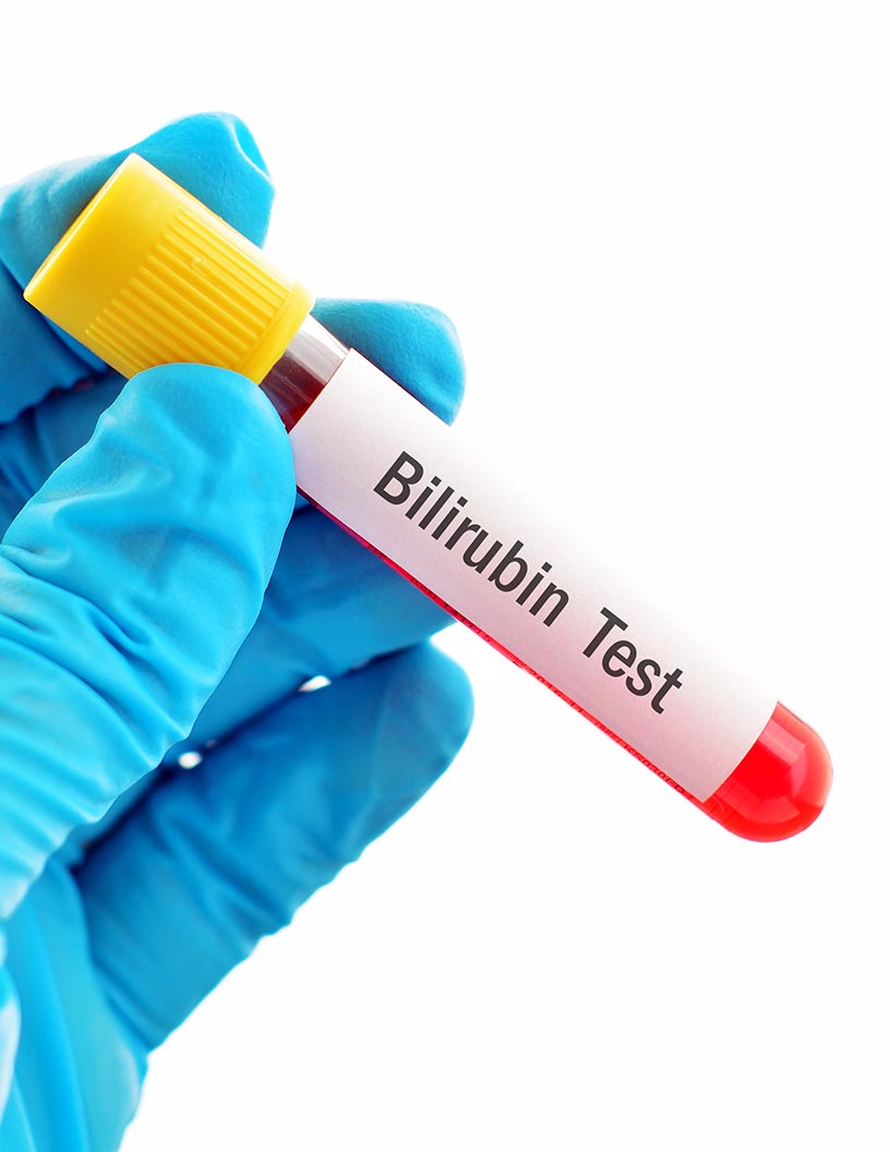 Global Bilirubin Blood Test Market 2024-2028