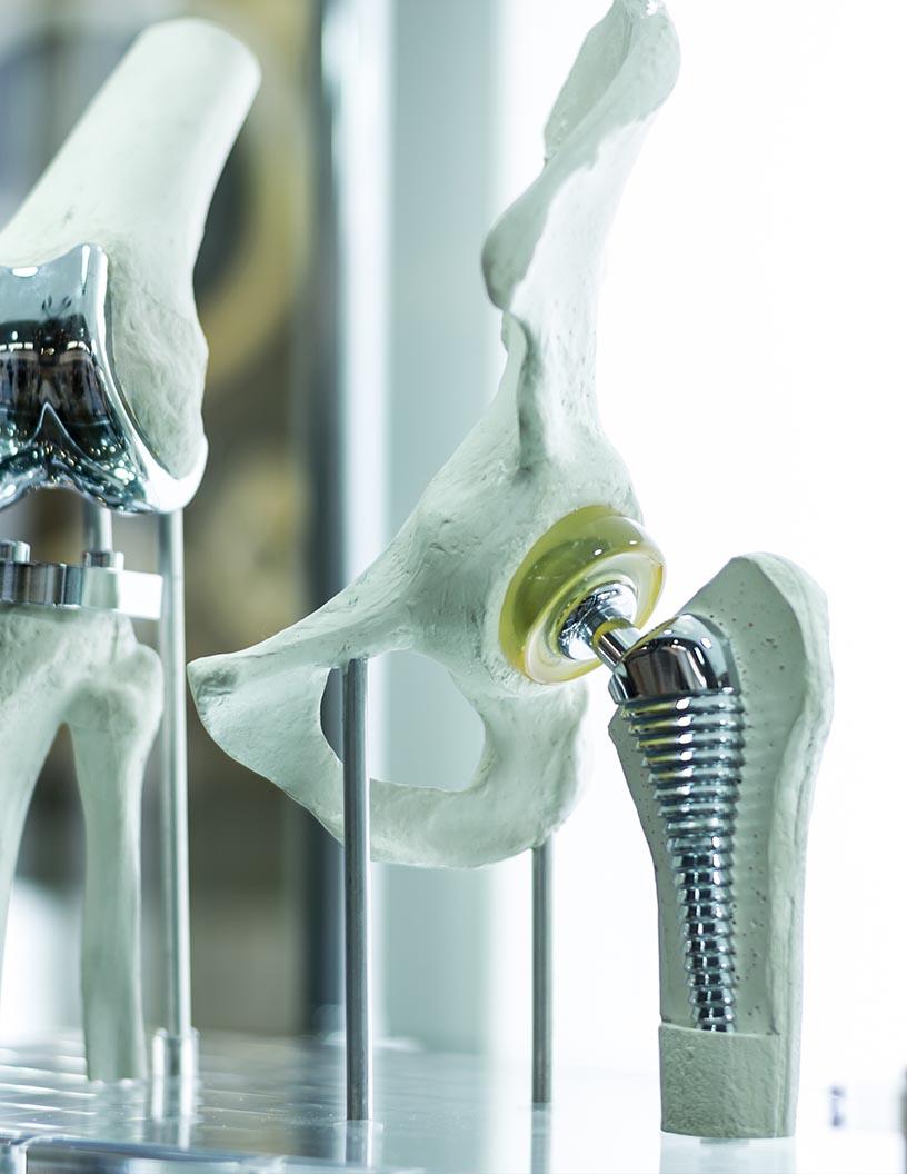 Global Spinal Implants Market 2025-2029