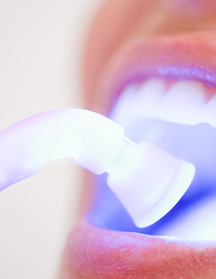 Global Teeth Whitening Market 2025-2029
