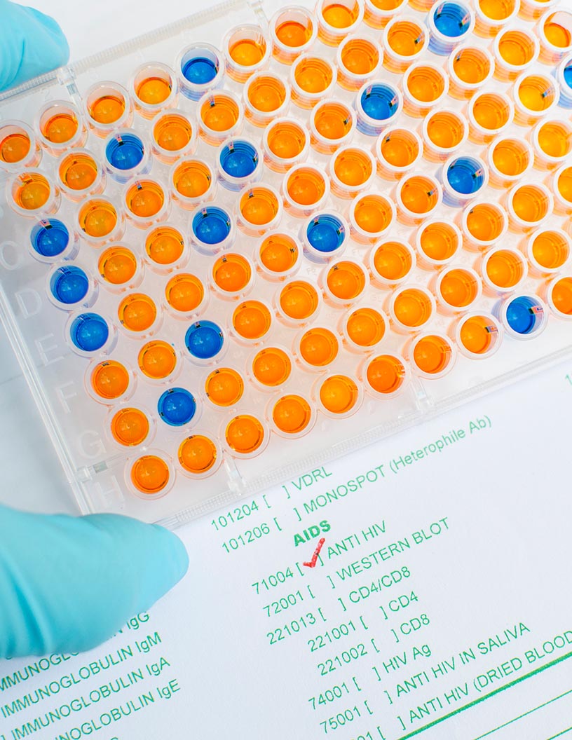 Global enzyme-linked immunosorbent assay (Elisa) market 2024-2028
