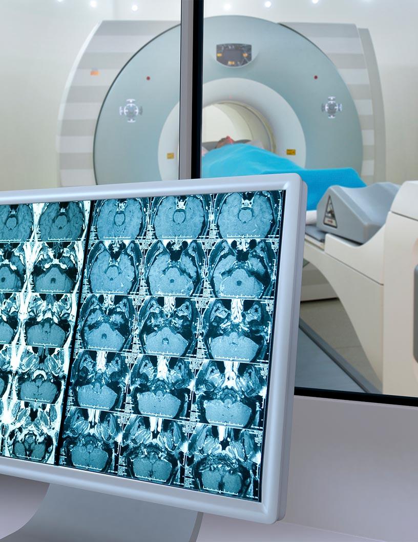 Global Picture Archiving And Communication System Market 2024-2028