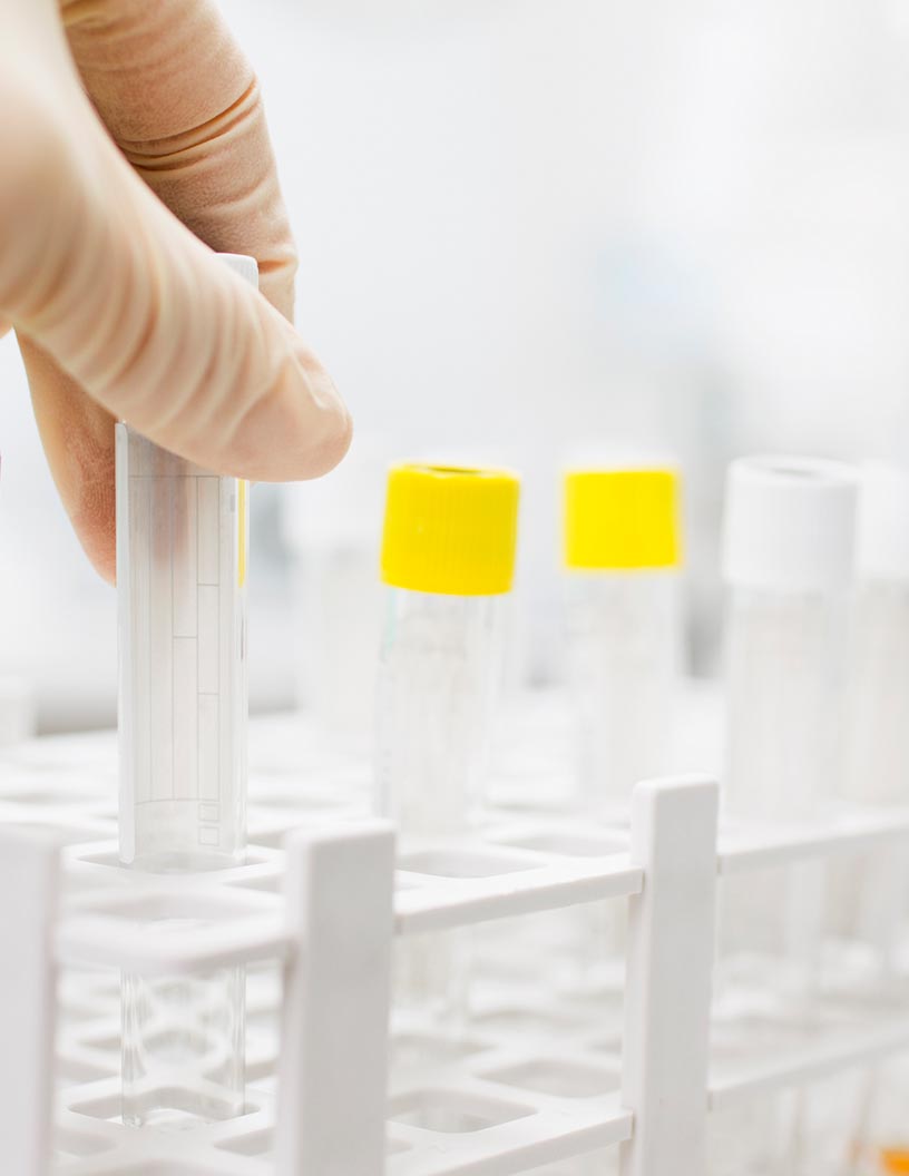 Antimicrobial Momentum: Government Overtures, Diagnostic Evolution, and a USD 51.4 Billion Market Flourish