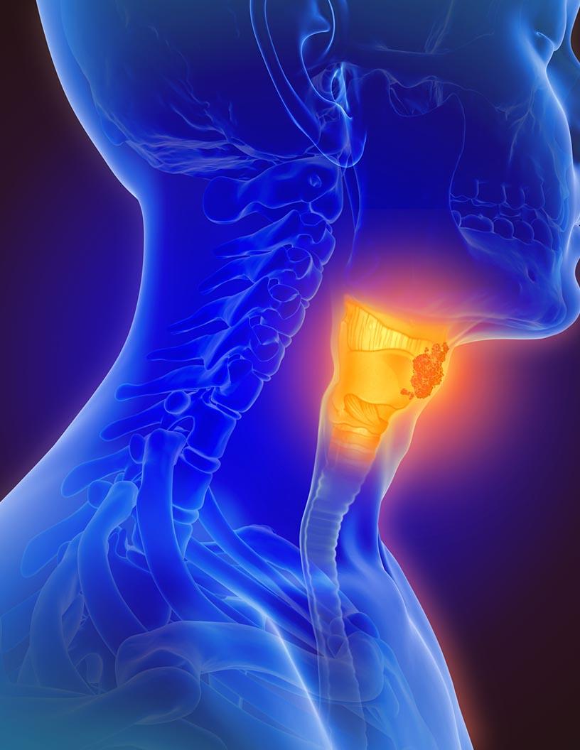 Global Upper Respiratory Tract Infection Treatment Market 2025-2029
