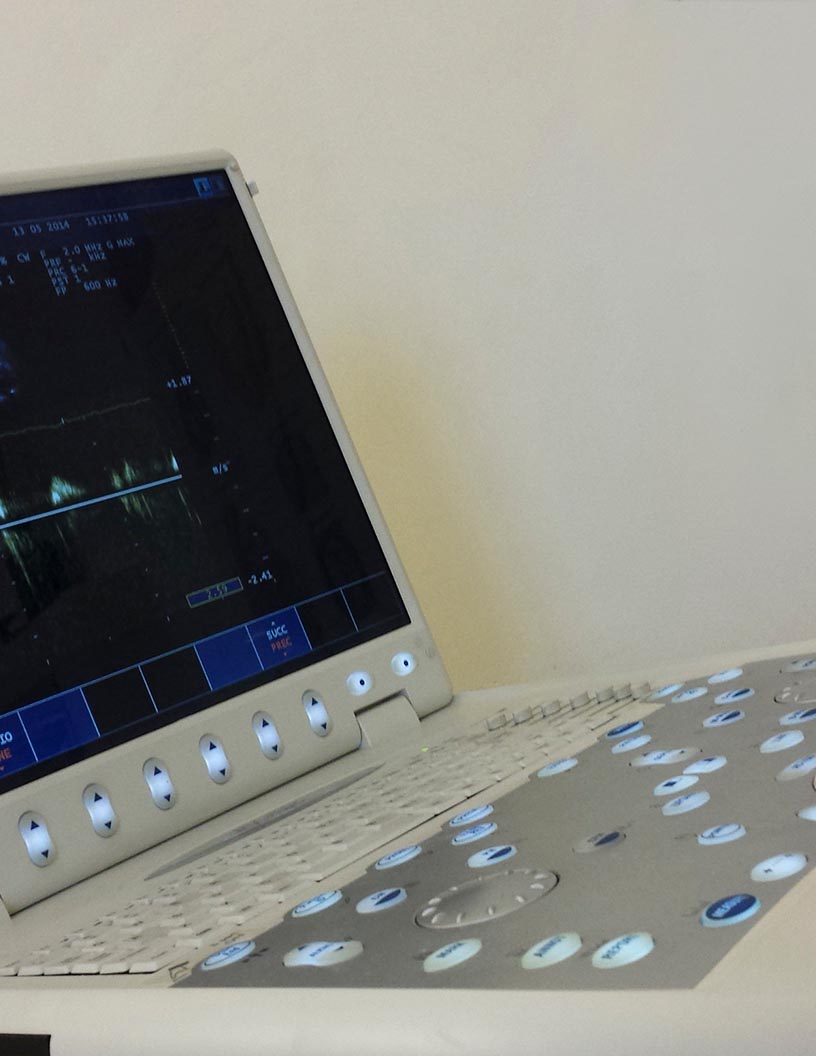 Global echocardiography (ECG) devices market 2024-2028