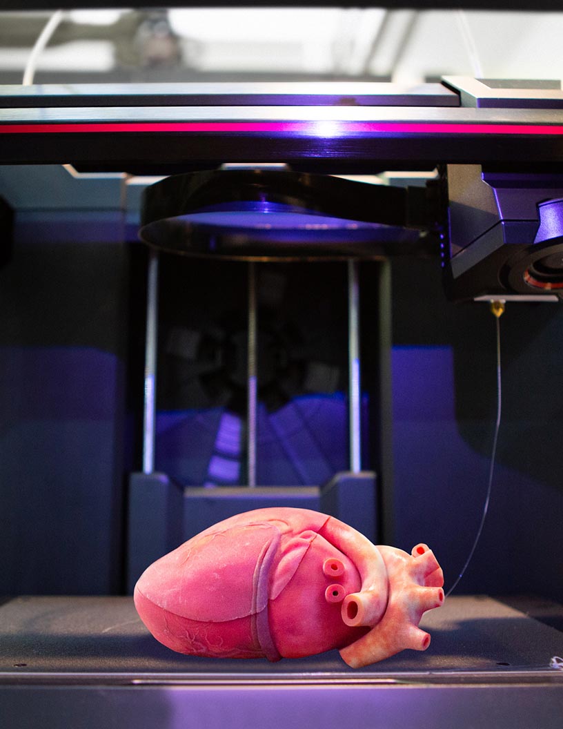 Global artificial organs market 2024-2028
