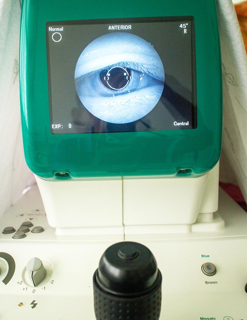 Global Fundus Camera Market 2025-2029