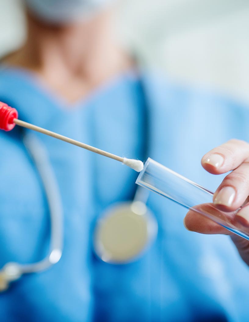Global influenza diagnostics market 2024-2028