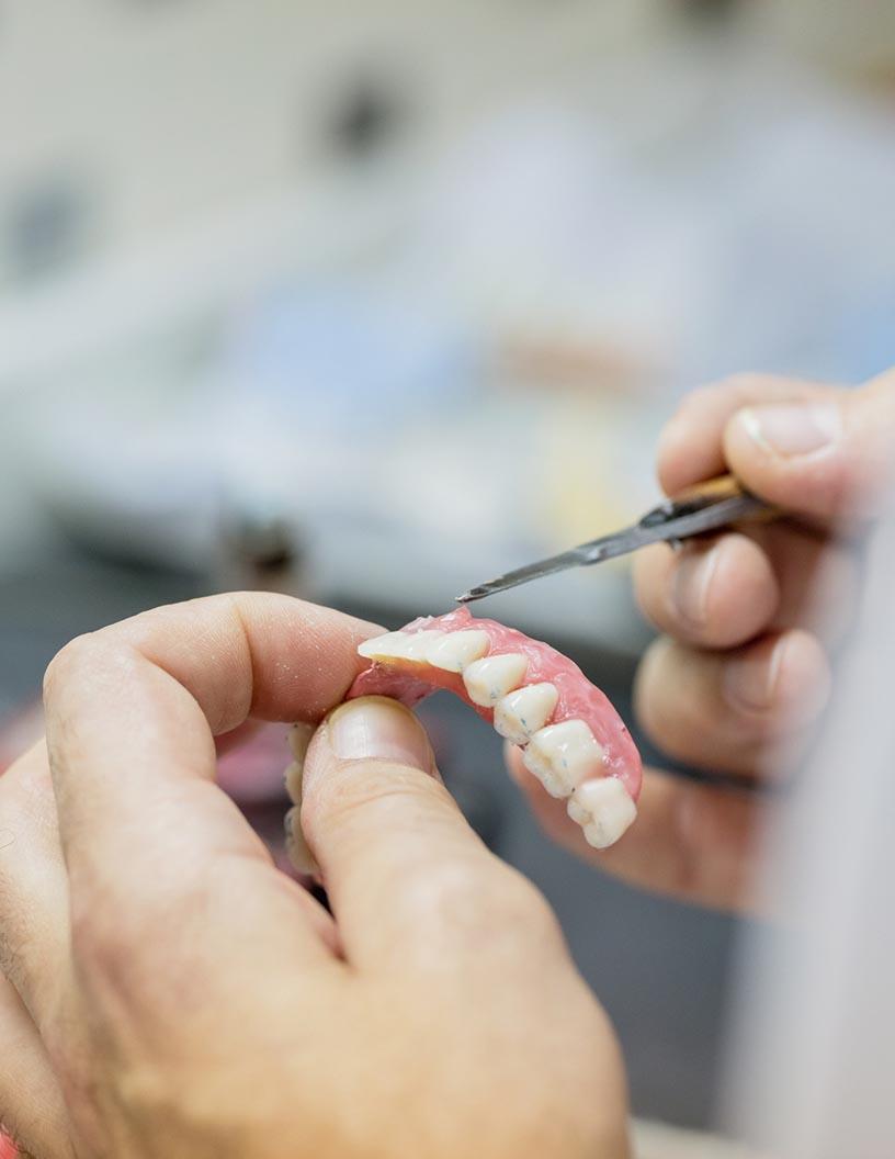 Global Dental Restoration Market 2025-2029