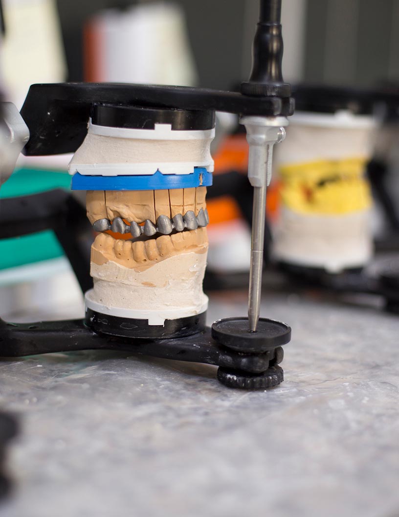 Global endodontics devices market 2024-2028