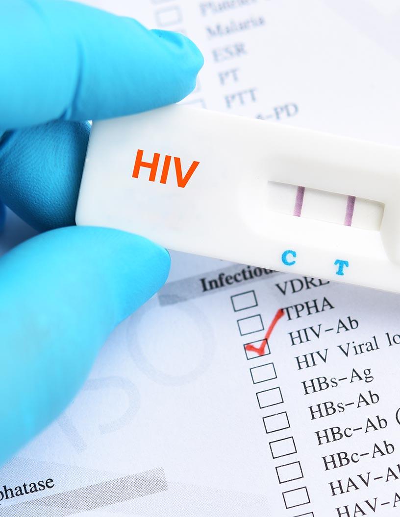Global Human Immunodeficiency Virus (HIV) Rapid Test Kits Market 2025-2029