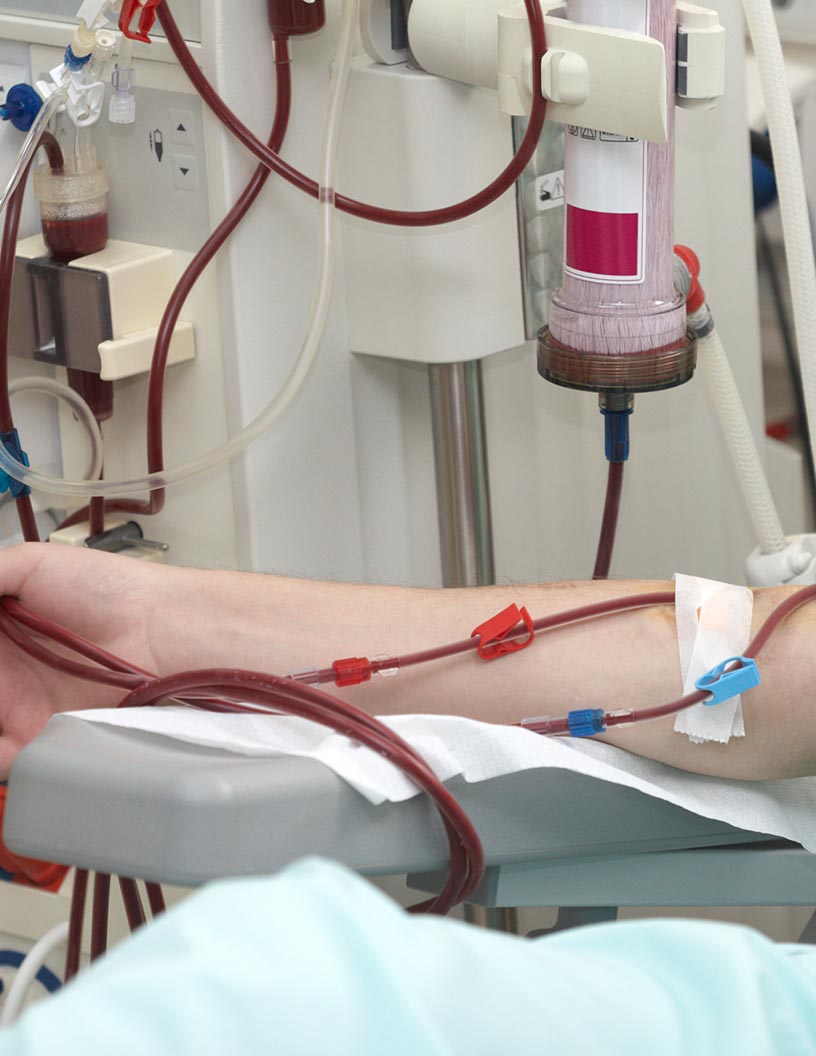 Global blood pressure (BP) transducers market 2024-2028
