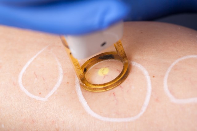 Top Drivers for Medical Laser Systems Market Size to Grow by $ 3.07 bn During 2020-2024