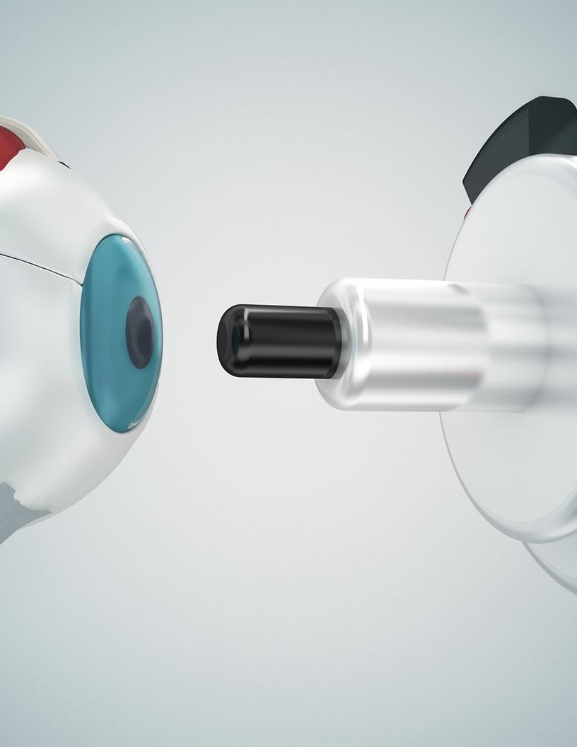 Global Ophthalmic Femtosecond Lasers Market 2024-2028