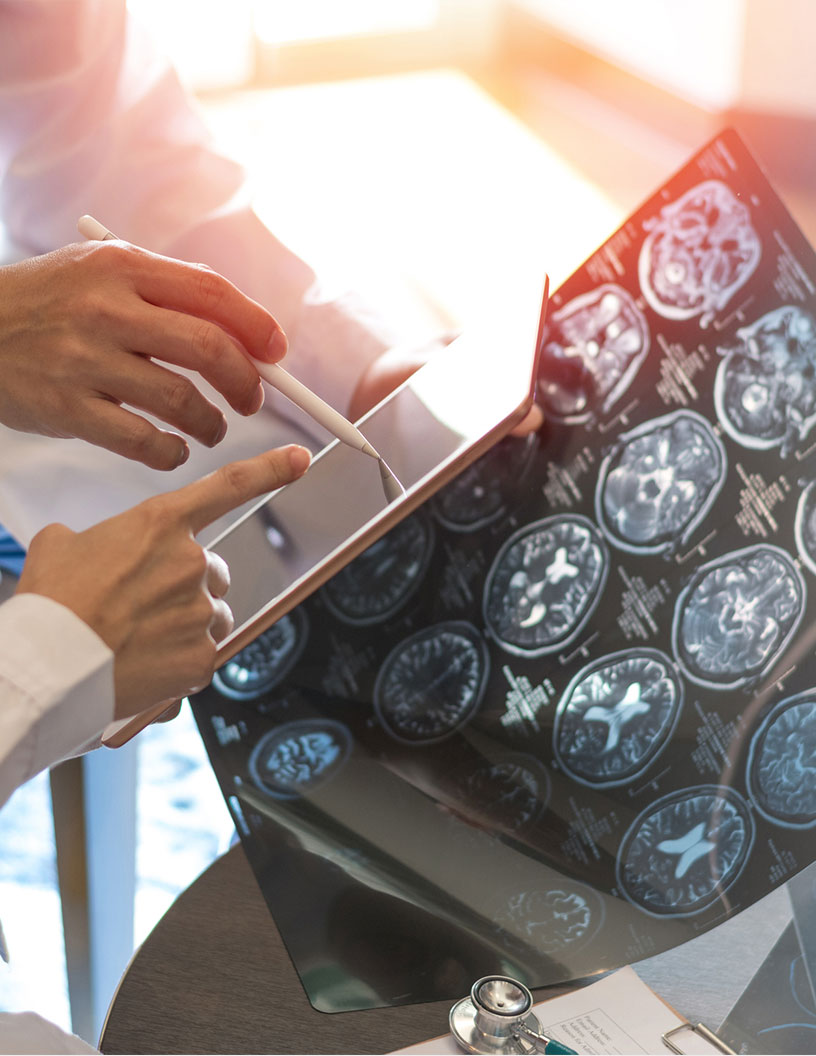 Global radiation oncology market 2024-2028