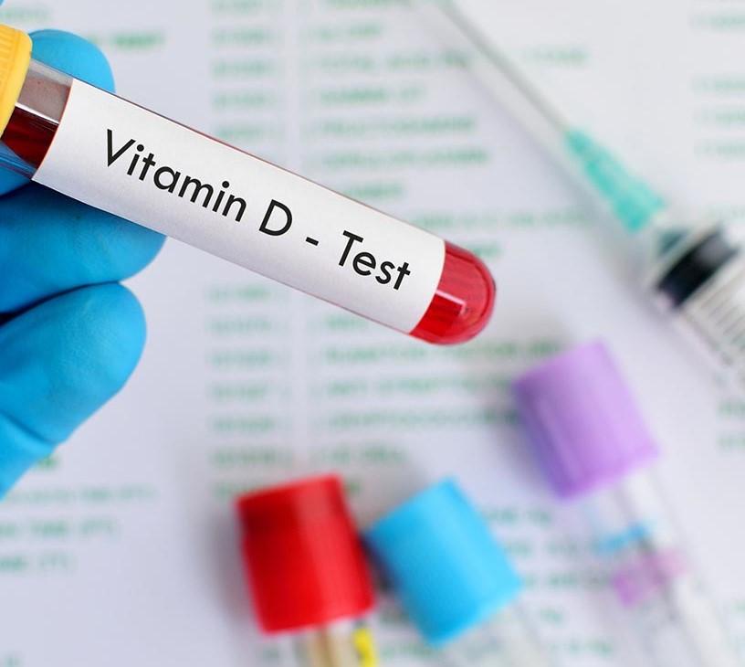 Global Vitamin D Testing Market 2025-2029