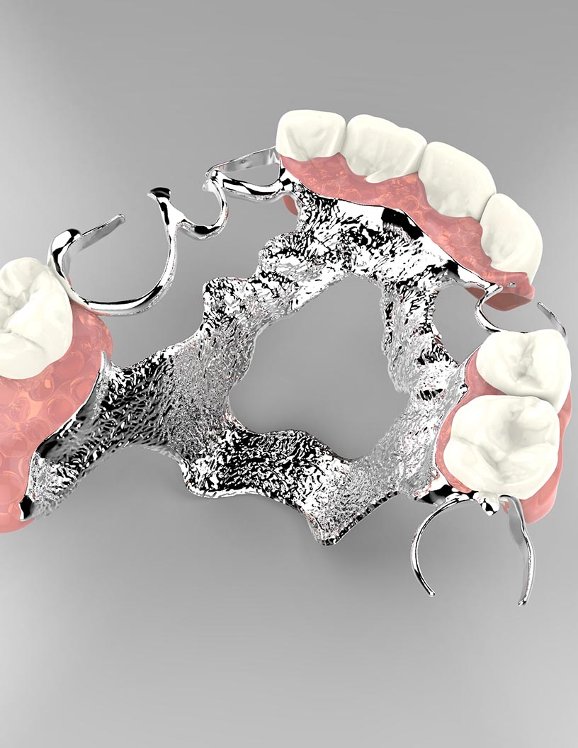 Global dental adhesives market 2024-2028