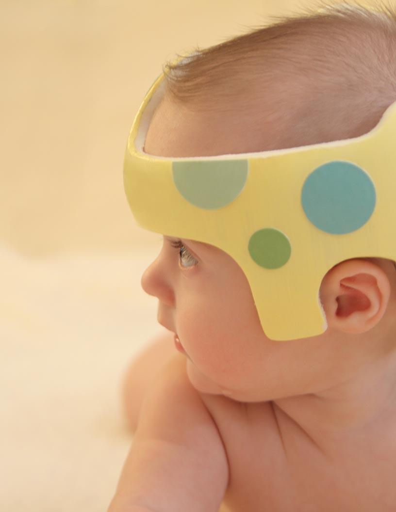 Global Cranial Orthoses Market 2025-2029