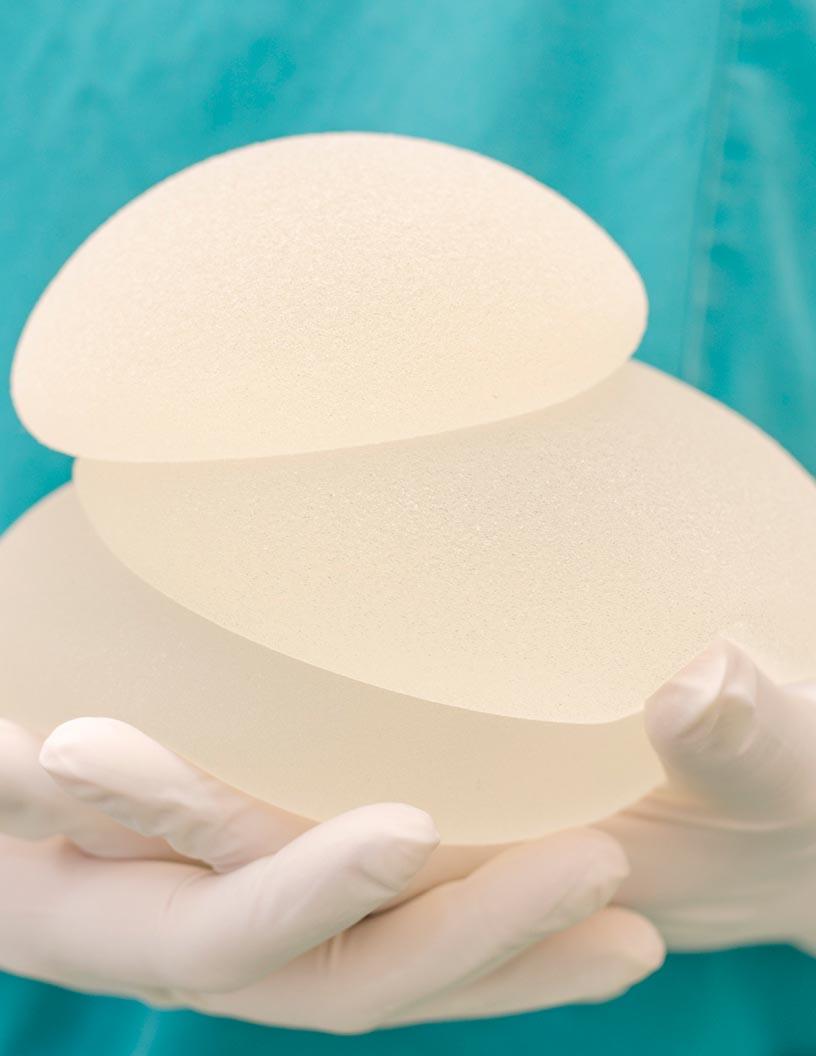 Global Breast Implant Market 2024-2028