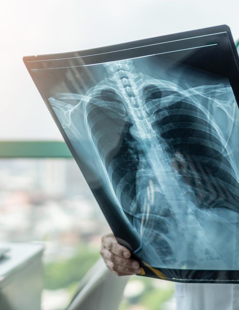 Global Chronic Obstructive Pulmonary Disease Drugs Market 2025-2029