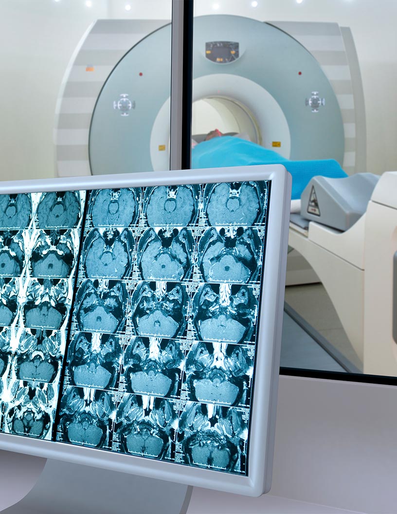 Oncology Clinical Trial Market Size to Grow by $ 4.22 bn through 2021-2025 | Leading Segments and Market Trends