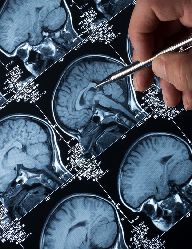Global Diagnostic Imaging Market 2023-2027