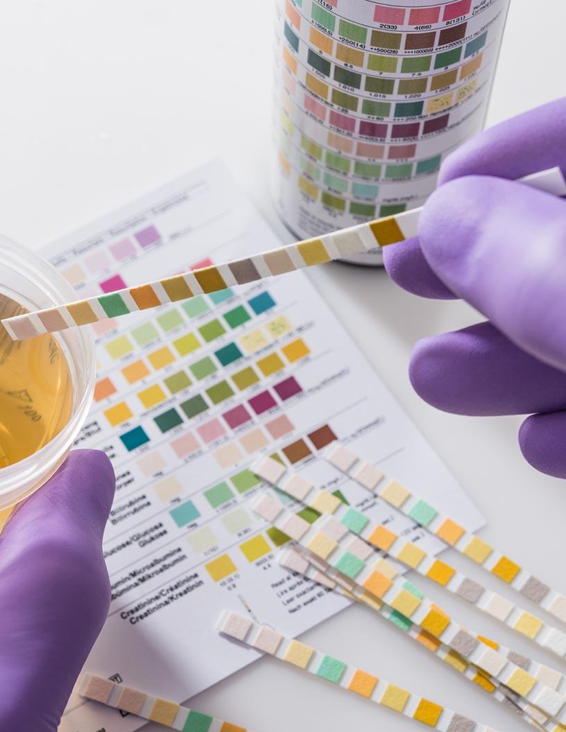 Global Protein Detection And Quantification Market 2024-2028