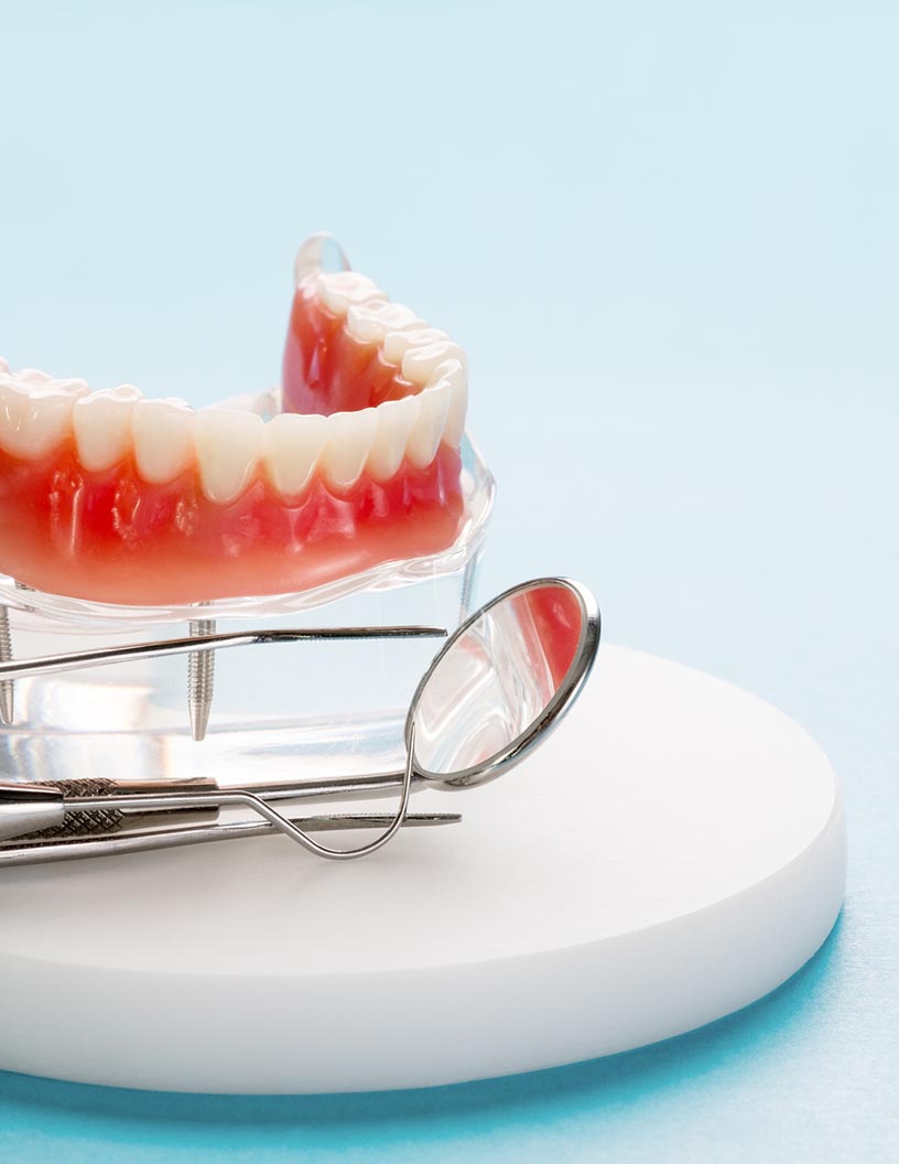 Dental Bone Graft Substitutes Market to Post Incremental Growth of $ 264.60 mn During 2021-2025 | Key Geographies that will Drive Growth