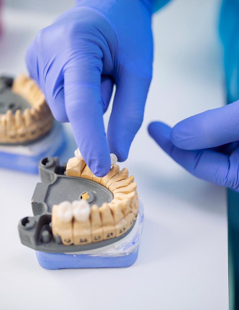 Global medical ceramics market 2024-2028