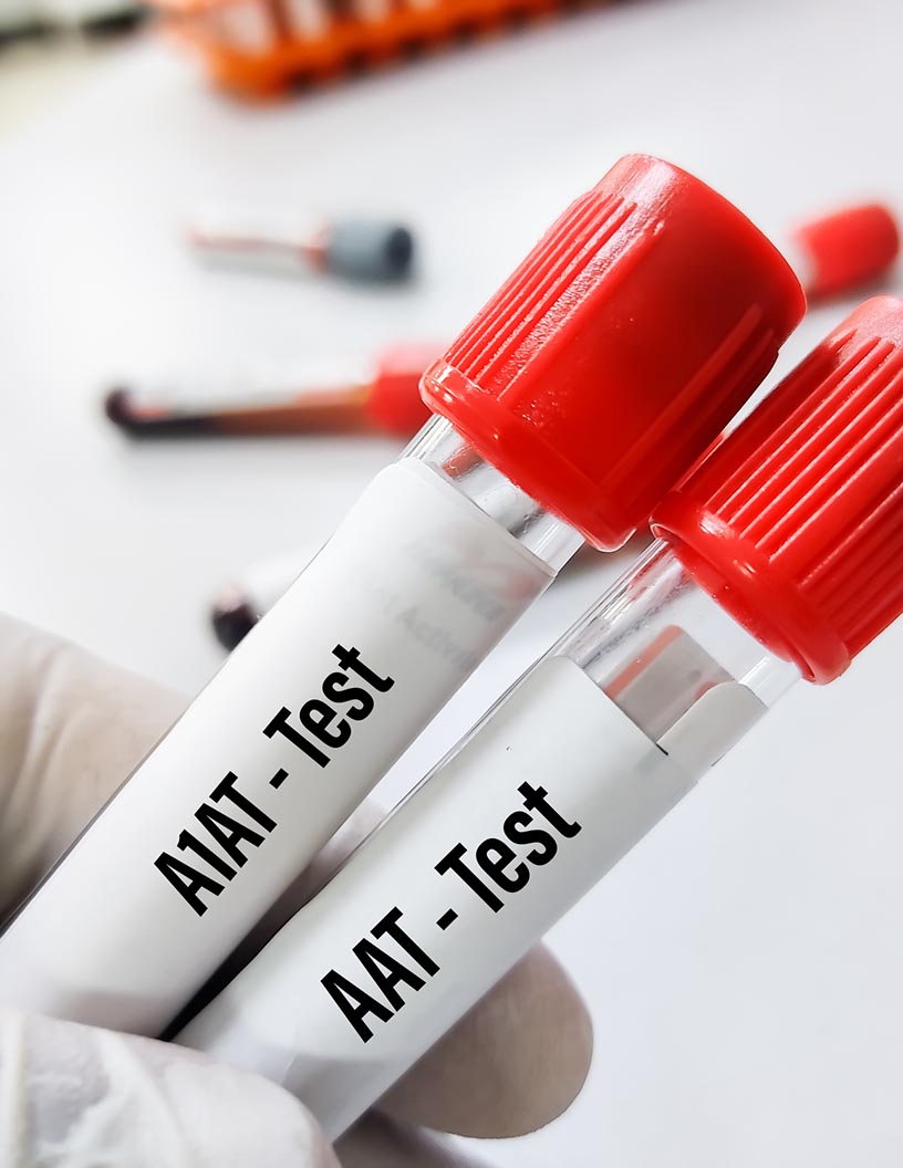 Global immunology market 2024-2028