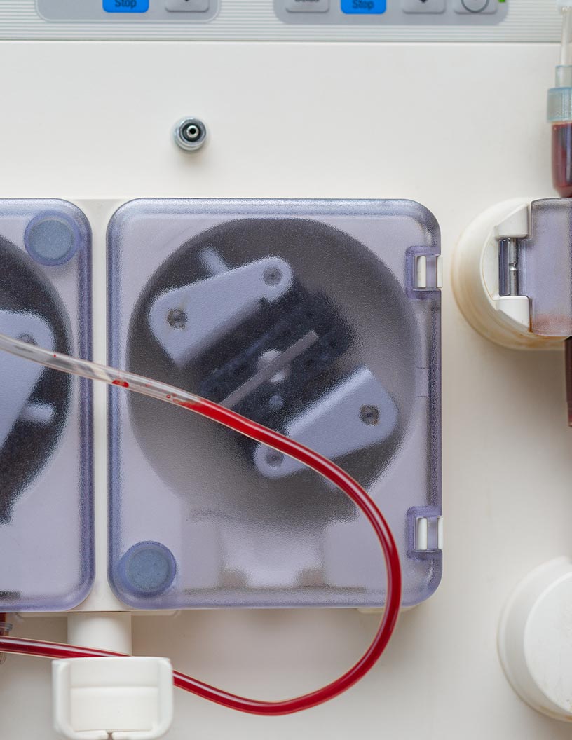 Global dialysis disposable devices market 2024-2028