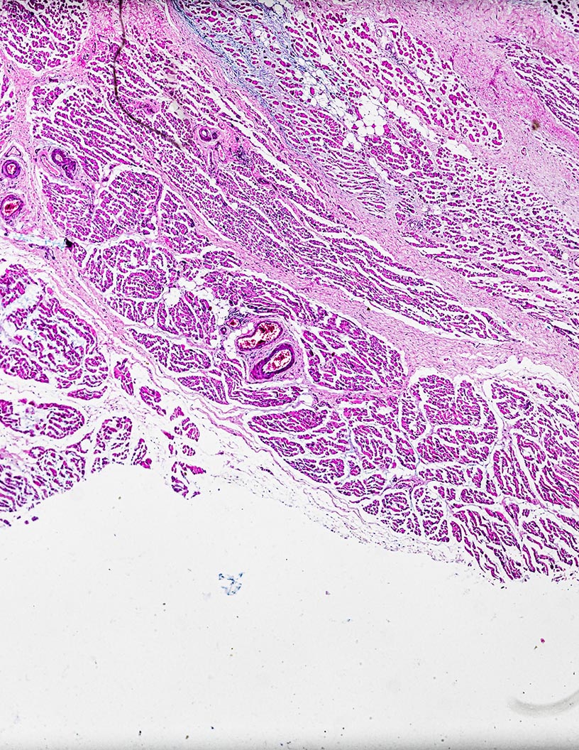 Global bone biopsy market 2024-2028