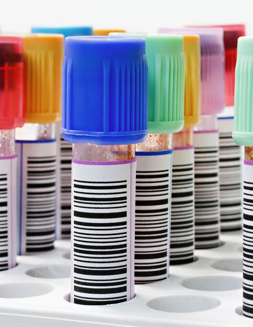 Global healthcare and laboratory labels market 2024-2028