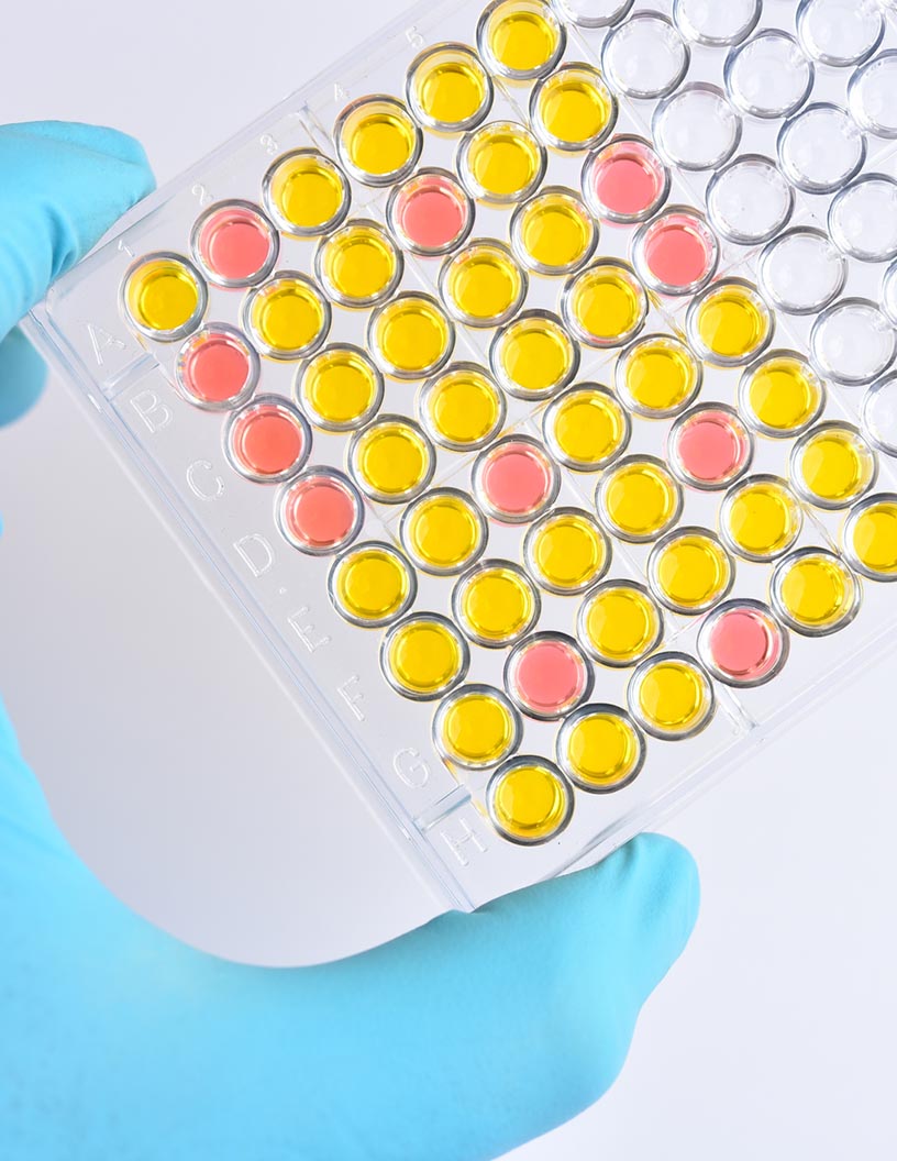 Global chemiluminescence immunoassay analyzers market 2024-2028