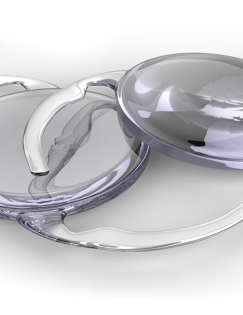 Intraocular lens market in india 2024-2028