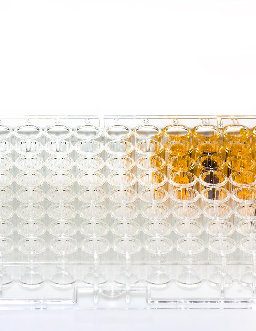 Global Immunoassay Market 2025-2029