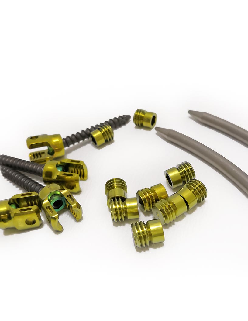 Pedicle Screw System Market Size to Grow by $ 212.03 mn through 2021-2025 | Leading Segments and Market Trends