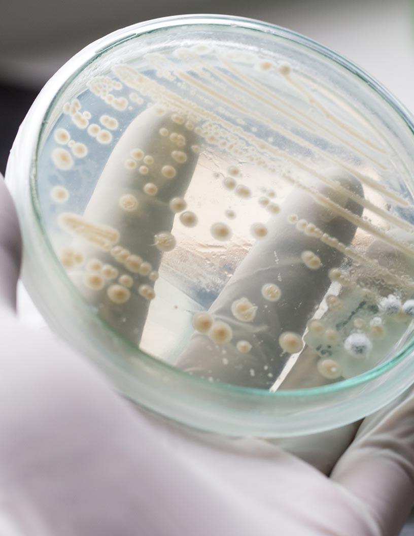Global Prils Market 2024-2028