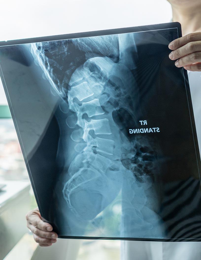 Global Neuromuscular Disease Therapeutics Market 2025-2029