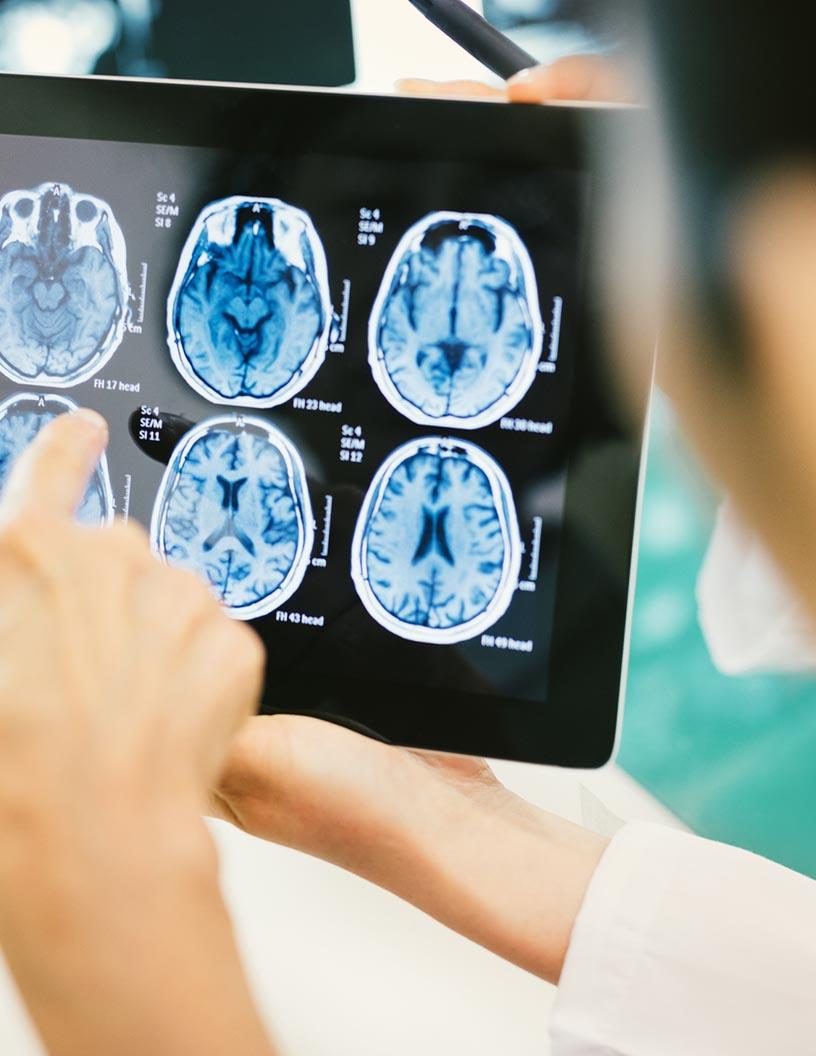 Global Brain Tumor Diagnostics Market 2024-2028