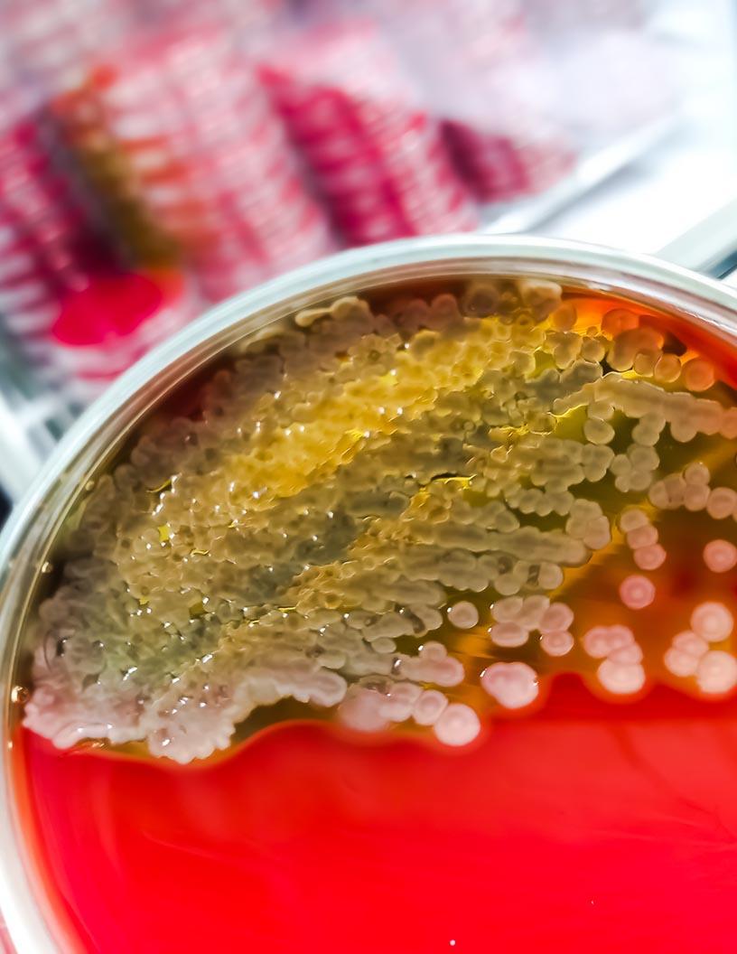 Global Animal Biotechnology Market 2025-2029