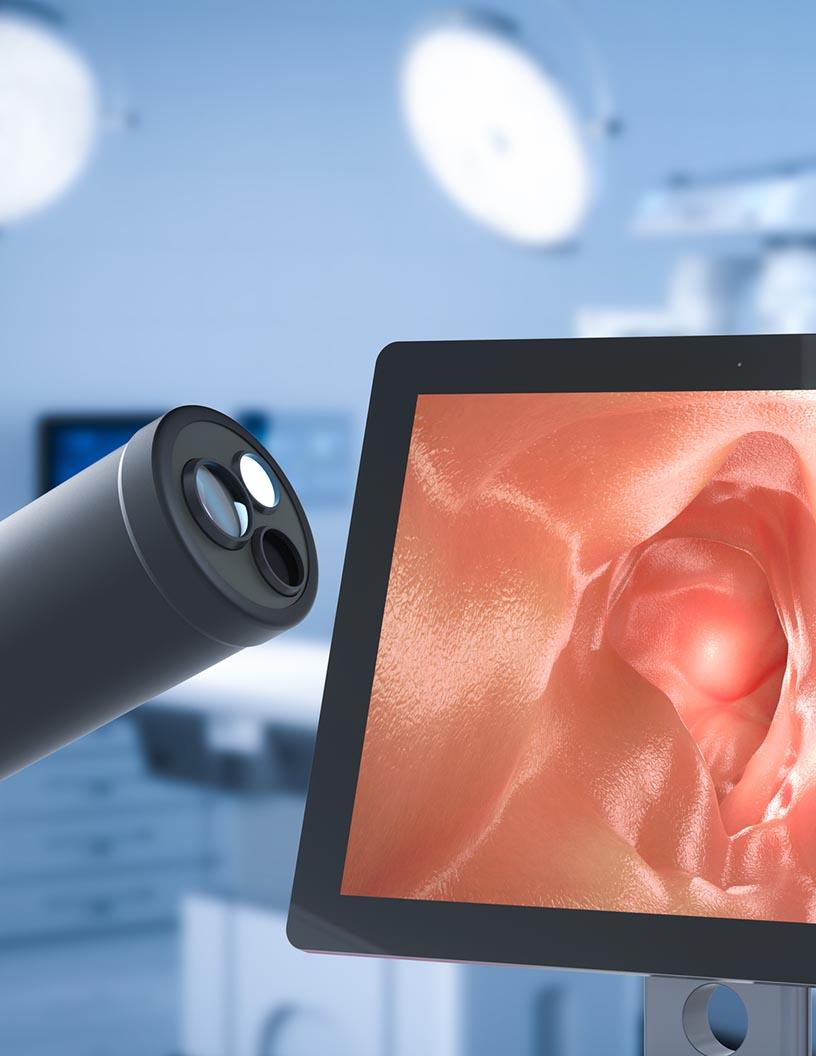 Endoscopy Devices Market in South Africa 2024-2028