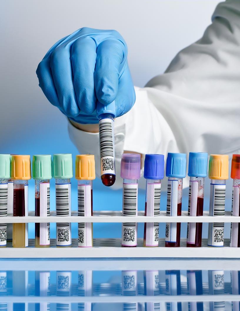 Global Carrier Screening Market 2025-2029