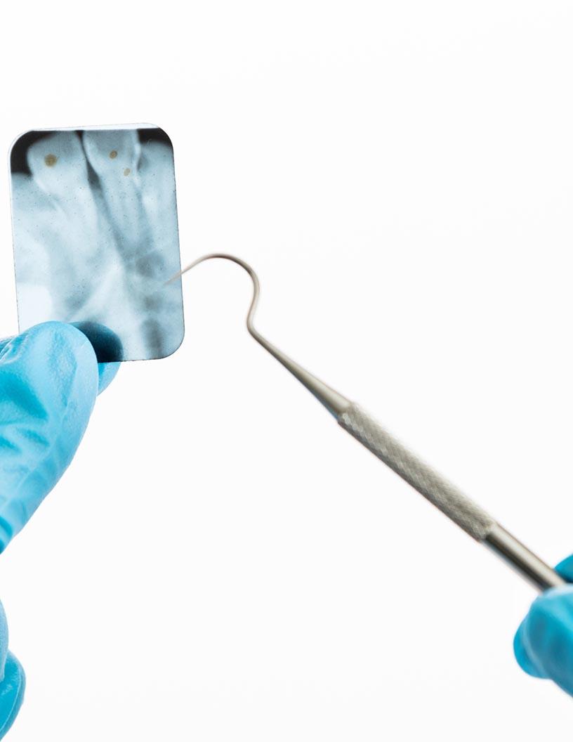Global Bone Staple Systems Market 2025-2029