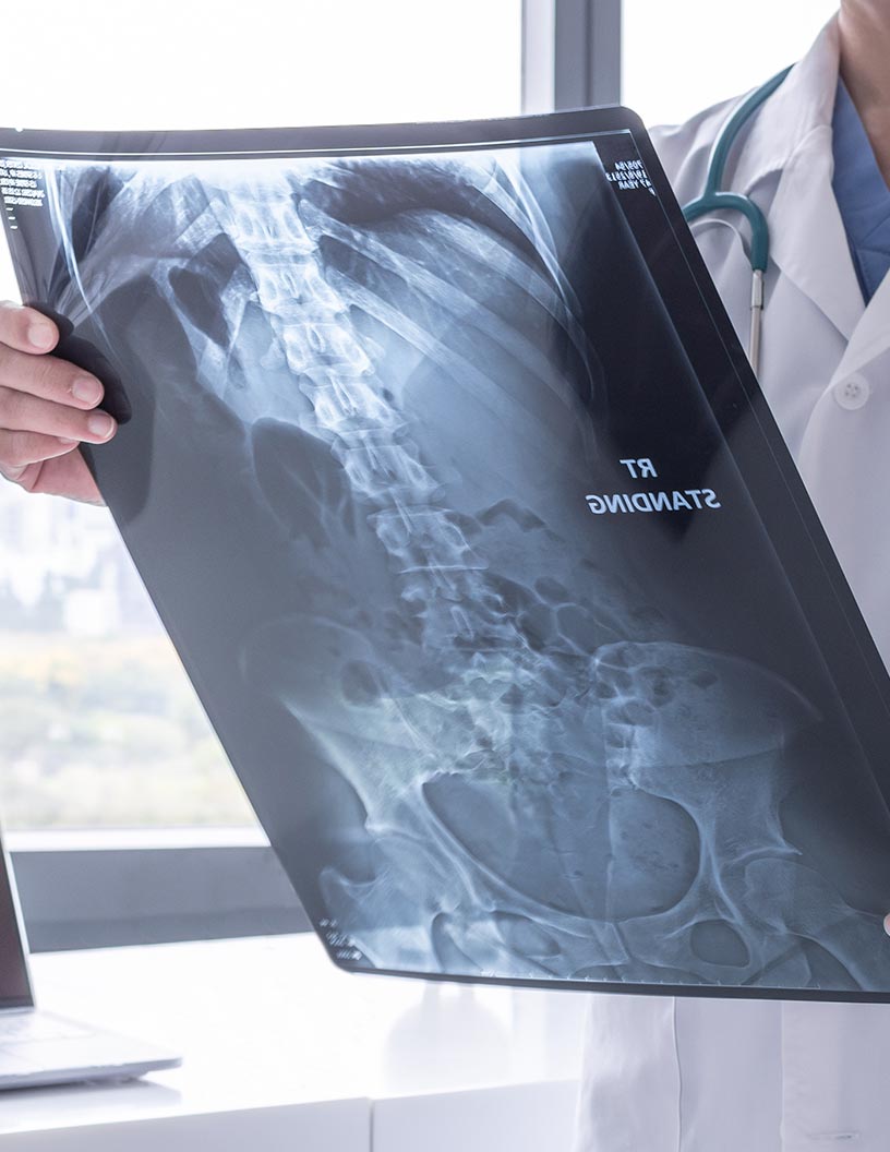 Global gastrointestinal bleeding treatment market 2024-2028